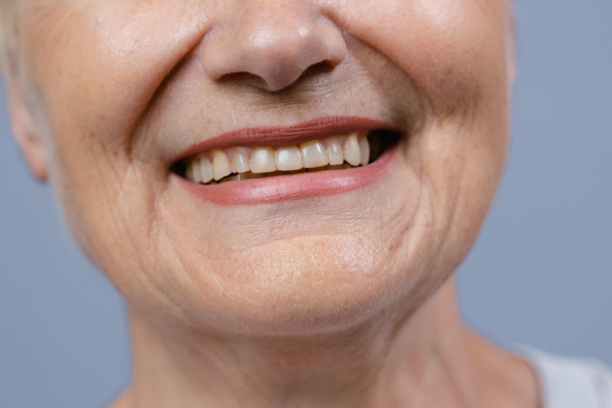 Dental Implants